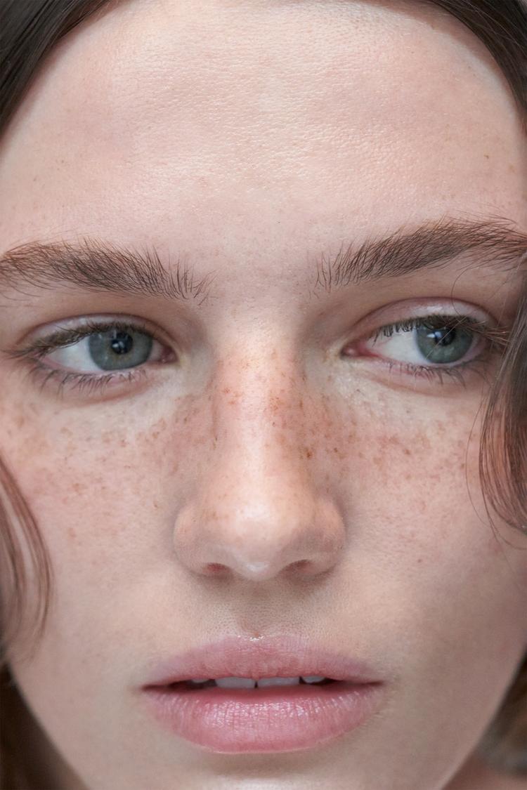 Freckles Freckles